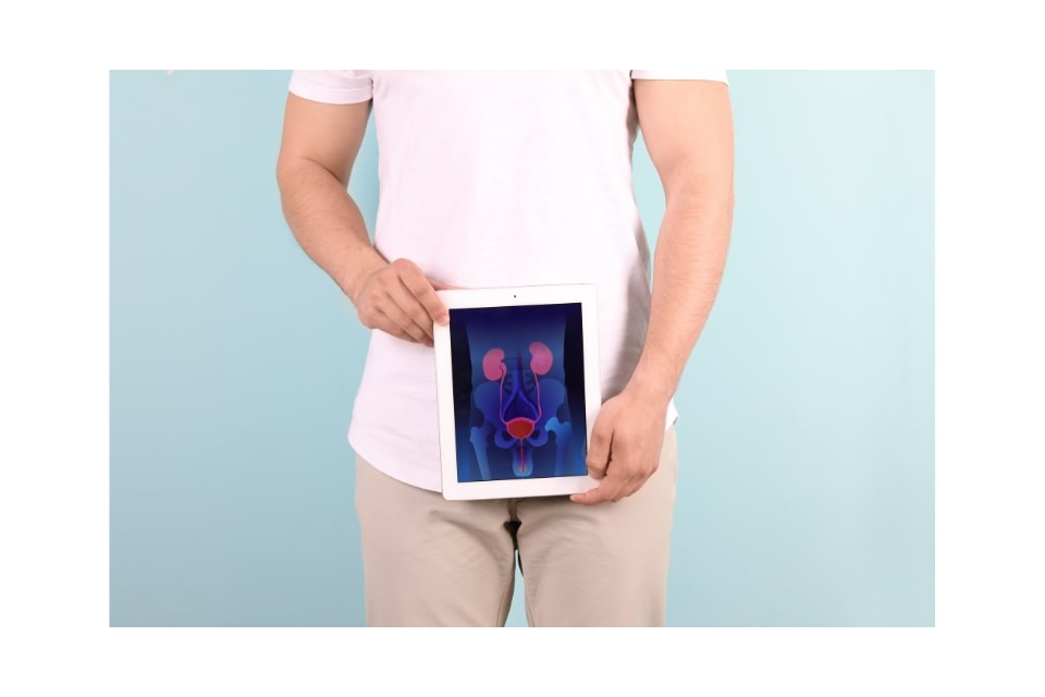 L’Embolisation Prostatique : Un Tournant Majeur dans le Traitement des Affections de la Prostate