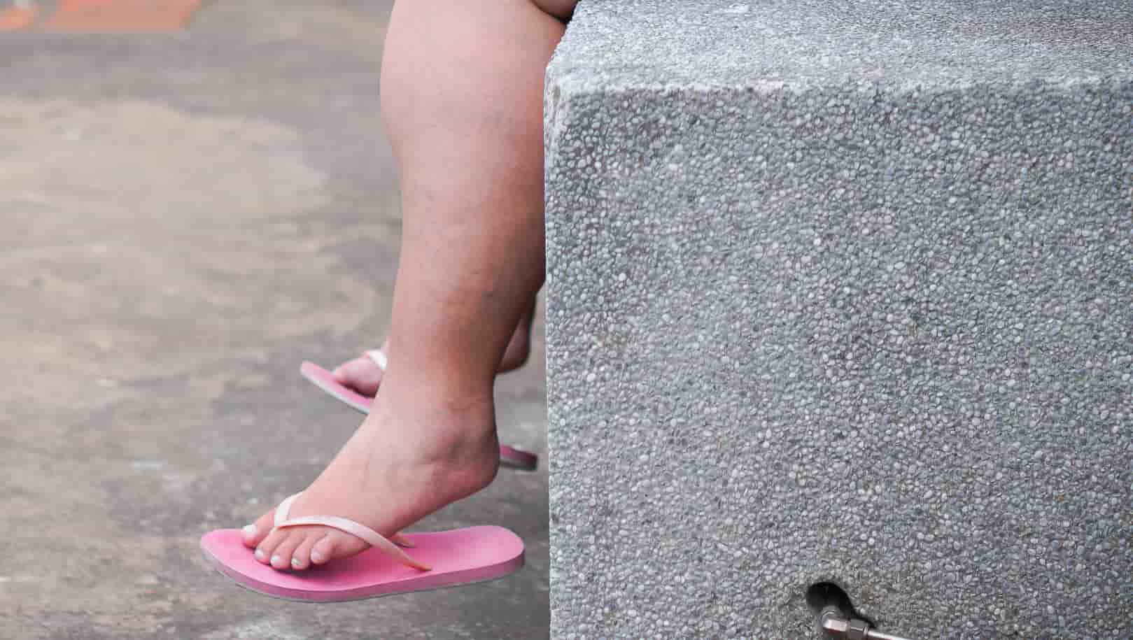 Comprendre la Rétention d’Eau et ses Liens avec les Troubles Hormonaux Troubles Hormonaux